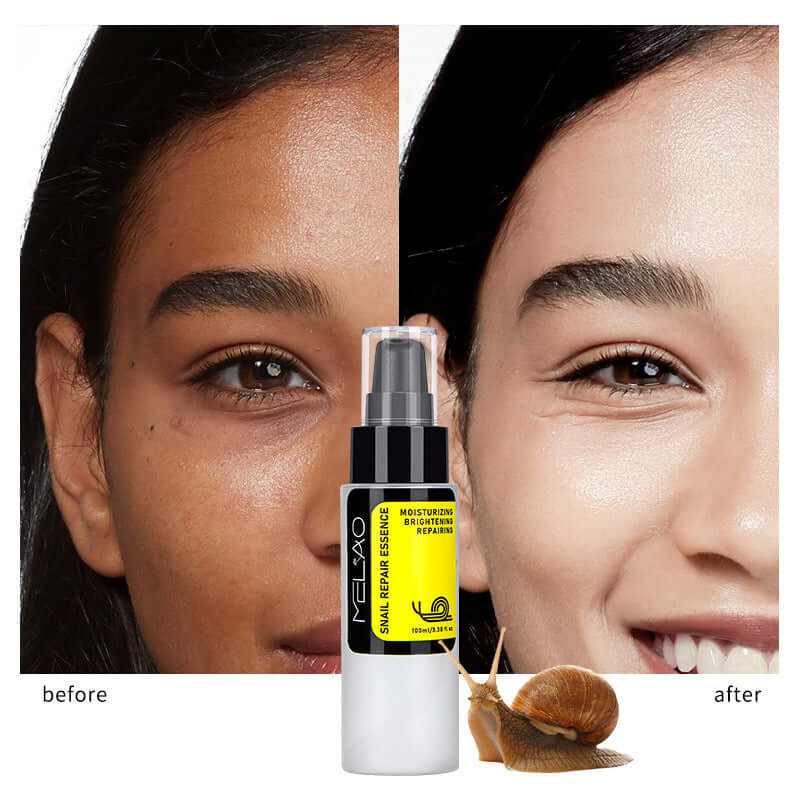 Solution de soin facial à la bave d&