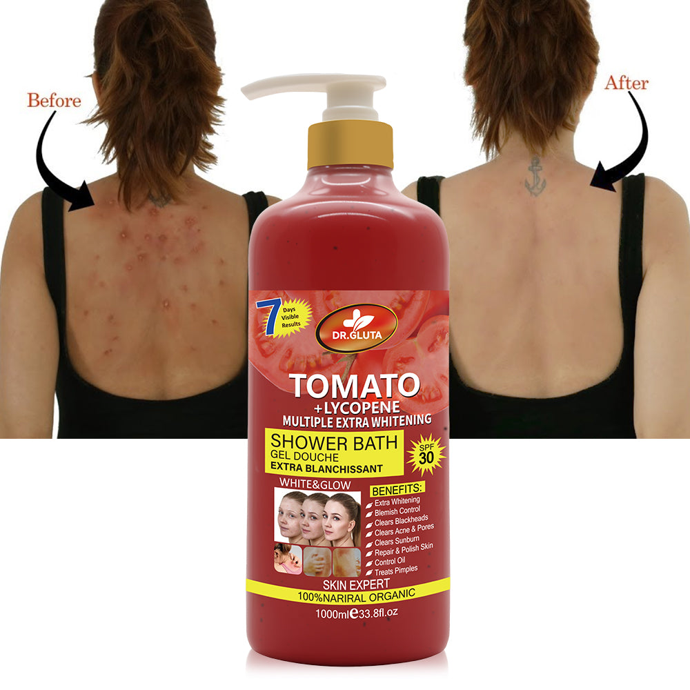 Gel douche exfoliant à la tomate, blanchissant et anti-âge, pour soin de la peau dans une bouteille de 4, marque non spécifiée.